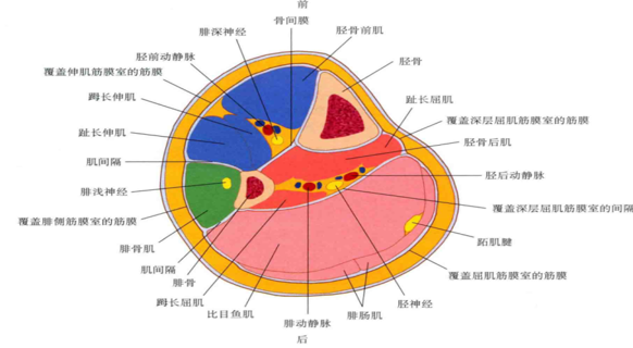 骨缺血坏死,骨髓炎粉碎骨折或者多节段骨折多合并软组织损伤骨筋膜室