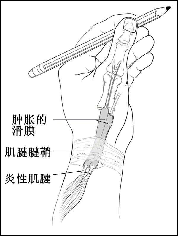 腕关节手绘图图片