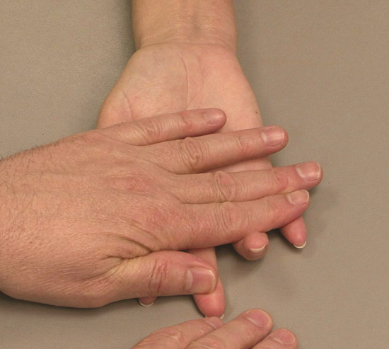 屈指浅肌(浅屈肌)拇指外展肌力(点击在线观看检查教程)握力(点击在线