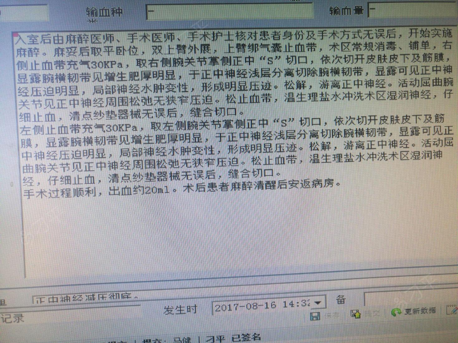 双侧腕管综合征