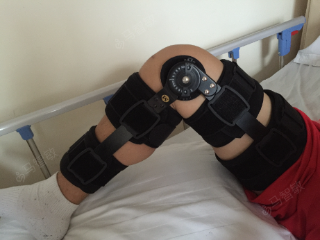 膝关节镜下前交叉韧带撕裂重建术一例